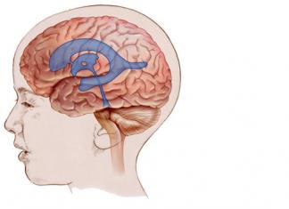Шунтирование сосудов головного мозга — как проводится операция и какие могут быть последствия?