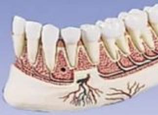 Хронический остеомиелит как осложнение экстракции зуба Остеомиелит зуба симптомы