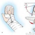 Способы лечения разрыва сухожилия на пальце руки